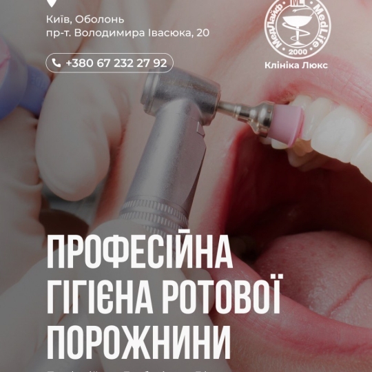 Професійна гігієна ротової порожнини